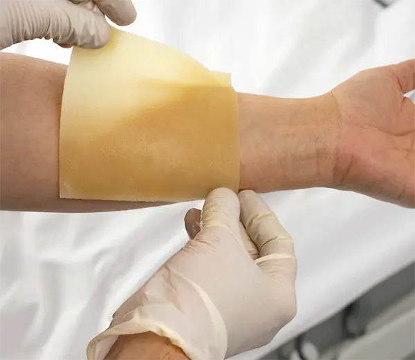 Xero Burn Dressing Dynarex